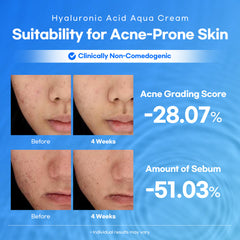 Lesimo Hyaluronic Acid Aqua Cream, Deep Hydration, Skin Barrier Strengthening, Lightweight Moisturizer / Vegan & Cruelty-Free, 3.38 fl.oz. (100mL)