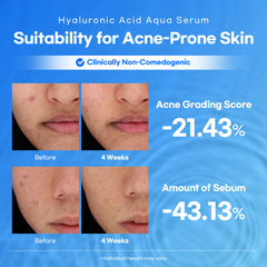 Lesimo Hyaluronic Acid Aqua Serum, Hydrating, Moisture Serum, Concentrated Anti-Aging Moisturizer for Dry, 1.69 fl.oz.(50mL)