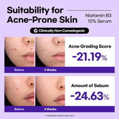 [Double] Lesimo Niatamin B3 10% Serum 1.69 fl.oz.(50mL)*2, Facial Serum for Glass skin / Vitamin B3, Niacinamide for Dark Spots, Suitable for Sensitive Skin / Vegan & Cruelty-Free